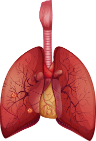 adenocarcinoma