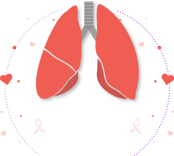 lung-cancer-1